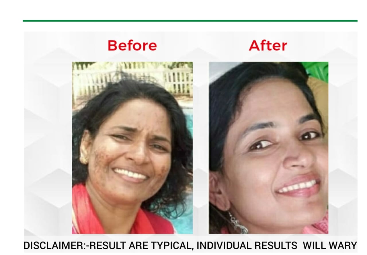 Shamila Sakkeer Wellness Coach