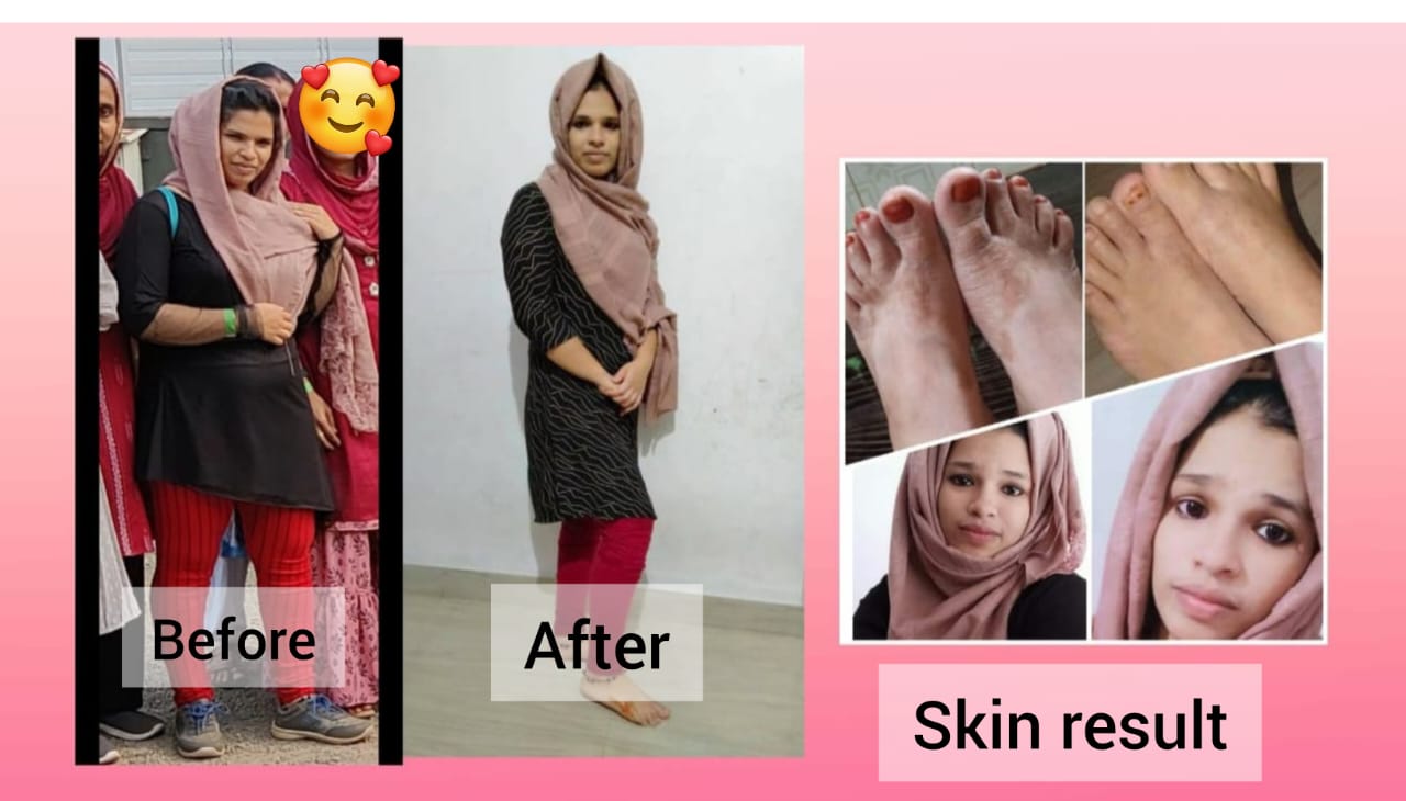 Shamila Sakkeer Wellness Coach